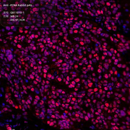 АНТИТЕЛА ПЕРВИЧНЫЕ, ПОЛИКЛОНАЛЬНЫЕ PCNA, РЕКОМБИНАНТНЫЕ, 100 МКЛ