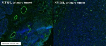 АНТИТЕЛА МОНОКЛОНАЛЬНЫЕ МЫШИНЫЕ ANTI-VEGFC [9/E7], 100 МКГ, ABCAM, AB106512